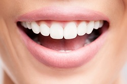 Why the Dentist Recommended Him Grafting?